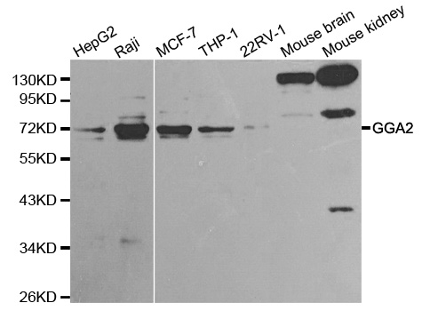 GGA2 Antibody - Western blot analysis of extracts of various cell lines, using GGA2 antibody at 1:1000 dilution. The secondary antibody used was an HRP Goat Anti-Rabbit IgG (H+L) at 1:10000 dilution. Lysates were loaded 25ug per lane and 3% nonfat dry milk in TBST was used for blocking.
