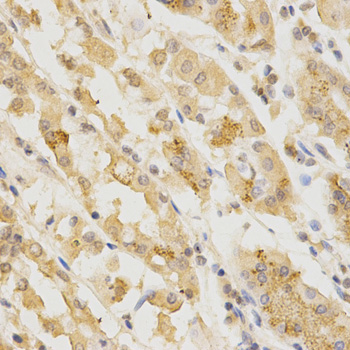 GGA2 Antibody - Immunohistochemistry of paraffin-embedded human stomach using GGA2 Antibodyat dilution of 1:200 (40x lens).