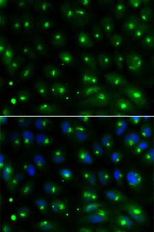 GGA2 Antibody - Immunofluorescence analysis of MCF-7 cells using GGA2 antibody. Blue: DAPI for nuclear staining.