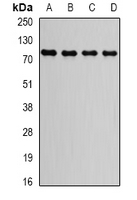 GGA2 Antibody - Western blot analysis of GGA2 expression in HepG2 (A); Raji (B); MCF7 (C); mouse brain (D) whole cell lysates.
