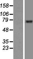 GGA2 Protein - Western validation with an anti-DDK antibody * L: Control HEK293 lysate R: Over-expression lysate
