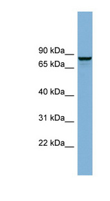 GGA3 Antibody - GGA3 antibody Western blot of Fetal Thymus lysate. This image was taken for the unconjugated form of this product. Other forms have not been tested.