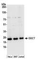 GGCT Antibody - Detection of human GGCT by western blot. Samples: Whole cell lysate (15 µg) from HeLa, HEK293T, and Jurkat cells prepared using NETN lysis buffer. Antibody: Affinity purified rabbit anti-GGCT antibody used for WB at 0.1 µg/ml. Detection: Chemiluminescence with an exposure time of 10 seconds.