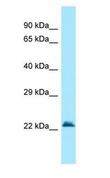 GGCT Antibody - GGCT antibody Western Blot of Fetal Lung.  This image was taken for the unconjugated form of this product. Other forms have not been tested.
