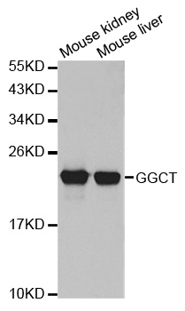 GGCT Antibody - Western blot analysis of extracts of various cell lines.