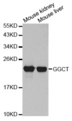 GGCT Antibody - Western blot analysis of extracts of various cell lines.