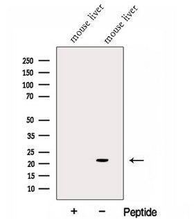 GGCT Antibody - Western blot analysis of extracts of mouse liver tissue using GGCT antibody. The lane on the left was treated with blocking peptide.