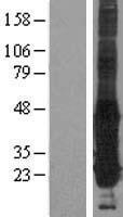 GGCT Protein - Western validation with an anti-DDK antibody * L: Control HEK293 lysate R: Over-expression lysate