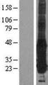 GGCT Protein - Western validation with an anti-DDK antibody * L: Control HEK293 lysate R: Over-expression lysate