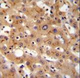 GGCX Antibody - GGCX Antibody immunohistochemistry of formalin-fixed and paraffin-embedded human liver tissue followed by peroxidase-conjugated secondary antibody and DAB staining.