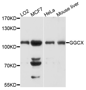 GGCX Antibody - Western blot analysis of extracts of various cells.