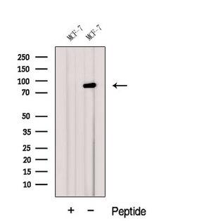 GGCX Antibody - Western blot analysis of extracts of HeLa cells using GGCX antibody. The lane on the left was treated with blocking peptide.