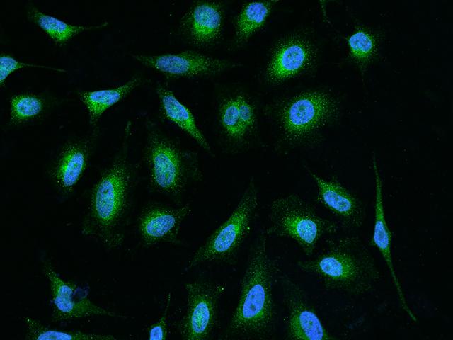 GGCX Antibody - Immunofluorescence staining of GGCX in HeLa cells. Cells were fixed with 4% PFA, permeabilzed with 0.1% Triton X-100 in PBS, blocked with 10% serum, and incubated with rabbit anti-Human GGCX polyclonal antibody (dilution ratio 1:200) at 4°C overnight. Then cells were stained with the Alexa Fluor 488-conjugated Goat Anti-rabbit IgG secondary antibody (green) and counterstained with DAPI (blue). Positive staining was localized to Cytoplasm.