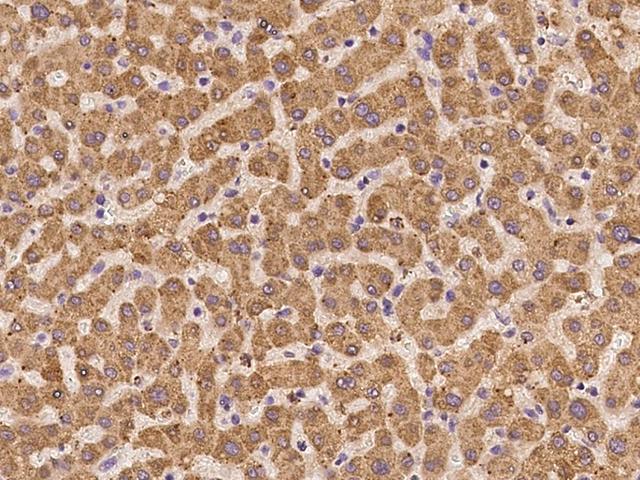 GGCX Antibody - Immunochemical staining of human GGCX in human liver with rabbit polyclonal antibody at 1:100 dilution, formalin-fixed paraffin embedded sections.
