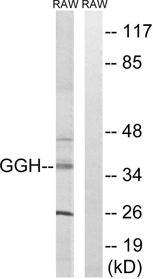 GGH / Gamma-Glutamyl Hydrolase Antibody - Western blot analysis of lysates from RAW264.7 cells, using GGH Antibody. The lane on the right is blocked with the synthesized peptide.