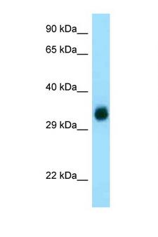 GGH / Gamma-Glutamyl Hydrolase Antibody - GGH / HGH antibody Western blot of Fetal Kidney lysate. Antibody concentration 1 ug/ml. This image was taken for the unconjugated form of this product. Other forms have not been tested.