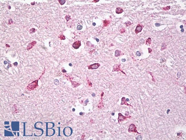 GGH / Gamma-Glutamyl Hydrolase Antibody - Anti-GH / HGH antibody IHC of human brain, cortex. Immunohistochemistry of formalin-fixed, paraffin-embedded tissue after heat-induced antigen retrieval. Antibody dilution 5-10 ug/ml. This image was taken for the unconjugated form of this product. Other forms have not been tested.