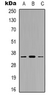 GGH / Gamma-Glutamyl Hydrolase Antibody - Western blot analysis of GGH expression in HepG2 (A); HeLa (B); RAW264.7 (C) whole cell lysates.