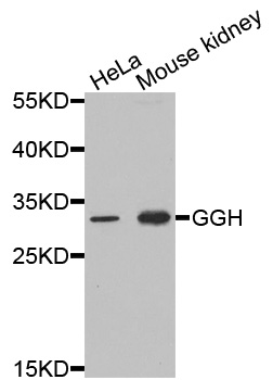 GGH / Gamma-Glutamyl Hydrolase Antibody - Western blot analysis of extracts of various cells.