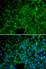 GGH / Gamma-Glutamyl Hydrolase Antibody - Immunofluorescence analysis of HeLa cells.