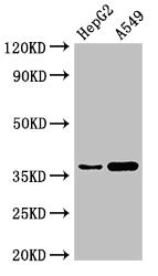 GGH / Gamma-Glutamyl Hydrolase Antibody - Western Blot Positive WB detected in:HepG2 whole cell lysate,A549 whole cell lysate All Lanes:GGH antibody at 3µg/ml Secondary Goat polyclonal to rabbit IgG at 1/50000 dilution Predicted band size: 38 KDa Observed band size: 38 KDa