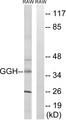 GGH / Gamma-Glutamyl Hydrolase Antibody - Western blot analysis of extracts from RAW264.7 cells, using GGH antibody.