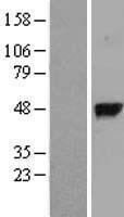 GGH / Gamma-Glutamyl Hydrolase Protein - Western validation with an anti-DDK antibody * L: Control HEK293 lysate R: Over-expression lysate