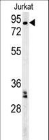 GGNBP2 / ZNF403 Antibody - GGNBP2 Antibody western blot of Jurkat cell line lysates (35 ug/lane). The GGNBP2 antibody detected the GGNBP2 protein (arrow).