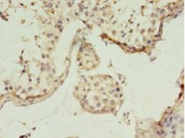 GGPS1 Antibody - Immunohistochemistry of paraffin-embedded human testis tissue using antibody at 1:100 dilution.  This image was taken for the unconjugated form of this product. Other forms have not been tested.