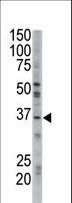 GGPS1 Antibody - The anti-GGPS1 antibody is used in Western blot to detect GGPS1 in mouse brain tissue lysate.