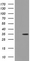 GGPS1 Antibody - HEK293T cells were transfected with the pCMV6-ENTRY control (Left lane) or pCMV6-ENTRY GGPS1 (Right lane) cDNA for 48 hrs and lysed. Equivalent amounts of cell lysates (5 ug per lane) were separated by SDS-PAGE and immunoblotted with anti-GGPS1.