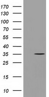GGPS1 Antibody - HEK293T cells were transfected with the pCMV6-ENTRY control (Left lane) or pCMV6-ENTRY GGPS1 (Right lane) cDNA for 48 hrs and lysed. Equivalent amounts of cell lysates (5 ug per lane) were separated by SDS-PAGE and immunoblotted with anti-GGPS1.