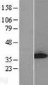 GGPS1 Protein - Western validation with an anti-DDK antibody * L: Control HEK293 lysate R: Over-expression lysate