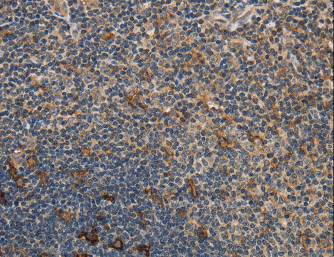 GGT1 / GGT Antibody - Immunohistochemistry of paraffin-embedded Human tonsil using GGT1 Polyclonal Antibody at dilution of 1:40.