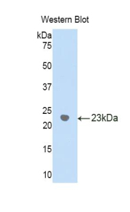 GGT1 / GGT Antibody - Western blot of recombinant GGT1 / GGT.  This image was taken for the unconjugated form of this product. Other forms have not been tested.