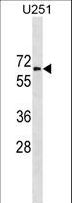 GGT1 / GGT Antibody - GGT1 Antibody western blot of U251 cell line lysates (35 ug/lane). The GGT1 antibody detected the GGT1 protein (arrow).