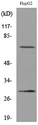 GGT1 / GGT Antibody - Western blot analysis of lysate from HepG2 cells, using GGT1 Antibody.