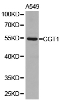 GGT1 / GGT Antibody - Western blot of extracts of A549 cell lines, using GGT1 antibody.