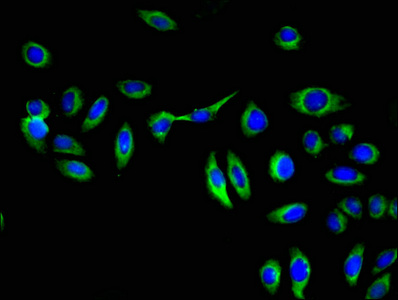 GGT1 / GGT Antibody - Immunofluorescent analysis of A549 cells at a dilution of 1:100 and Alexa Fluor 488-congugated AffiniPure Goat Anti-Rabbit IgG(H+L)