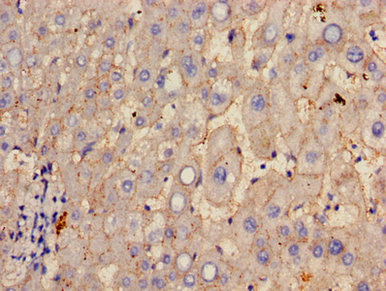 GGT1 / GGT Antibody - Immunohistochemistry image of paraffin-embedded human liver tissue at a dilution of 1:100