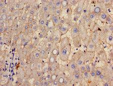 GGT1 / GGT Antibody - Immunohistochemistry image of paraffin-embedded human liver tissue at a dilution of 1:100