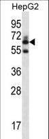 GGT2 Antibody - GGT2 Antibody western blot of HepG2 cell line lysates (35 ug/lane). The GGT2 antibody detected the GGT2 protein (arrow).