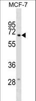 GGT6 Antibody - GGT6 Antibody western blot of MCF-7 cell line lysates (35 ug/lane). The GGT6 antibody detected the GGT6 protein (arrow).