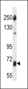GGT7 Antibody - GGT7 Antibody western blot of uterus tumor cell line lysates (35 ug/lane). The GGT7 antibody detected the GGT7 protein (arrow).
