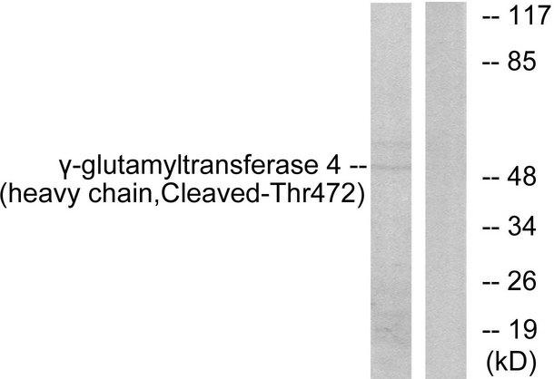 GGT7 Antibody - Western blot analysis of extracts from Jurkat cells, treated with etoposide (25uM, 24hours), using Gamma-glutamyltransferase 4 (heavy chain, Cleaved-Thr472) antibody.
