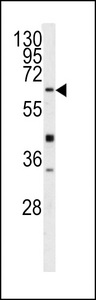 GGTLA1 / GGT5 Antibody - Western blot of GGTLA1 antibody in Y79 cell line lysates (35 ug/lane). GGTLA1 (arrow) was detected using the purified antibody.