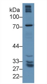 GGTLA1 / GGT5 Antibody - Western Blot; Sample: Human Lung lysate; Primary Ab: 1µg/ml Rabbit Anti-Human gGT5 Antibody Second Ab: 0.2µg/mL HRP-Linked Caprine Anti-Rabbit IgG Polyclonal Antibody