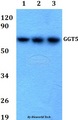 GGTLA1 / GGT5 Antibody - Western blot of GGT5 antibody at 1:500 dilution. Lane 1: A549 whole cell lysate. Lane 2: sp2/0 whole cell lysate. Lane 3: H9C2 whole cell lysate.
