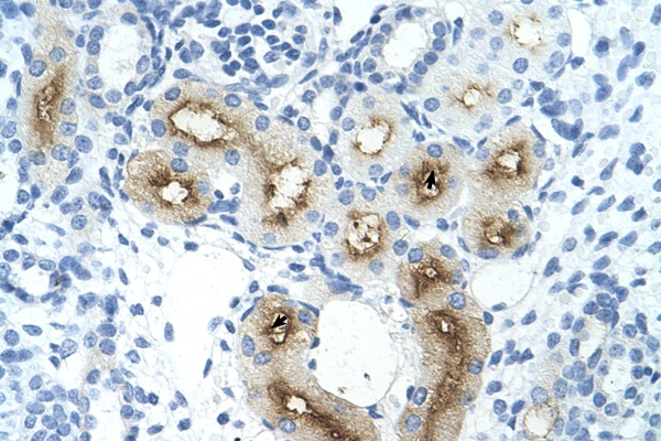GGTLA4 / GGTLC1 Antibody - GGTLC1 / GGTLA4 antibody ARP41639_T100-NP_563577-GGTLA4(gamma-glutamyltransferase-like activity 4) Antibody IHC of formalin-fixed, paraffin-embedded human Kidney. Positive label: Epithelial cells of renal tubule indicated with arrows. Antibody concentration 4-8 ug/ml. Magnification 400X.  This image was taken for the unconjugated form of this product. Other forms have not been tested.