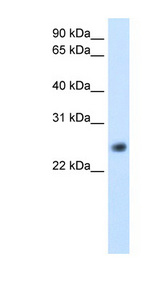 GGTLA4 / GGTLC1 Antibody - GGTLC1 / GGTLA4 antibody ARP41639_T100-NP_563577-GGTLA4(gamma-glutamyltransferase-like activity 4) Antibody Western blot of Fetal Kidney lysate.  This image was taken for the unconjugated form of this product. Other forms have not been tested.